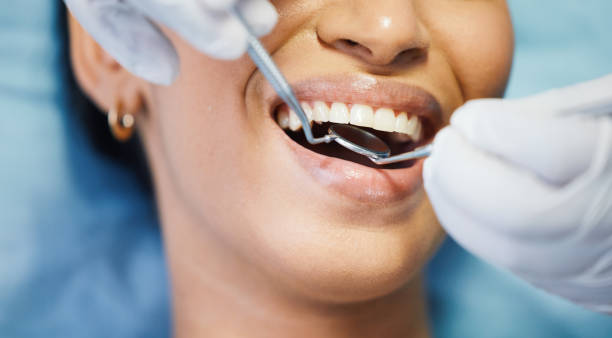 Best Emergency Root Canal Treatment in Holyoke, CO