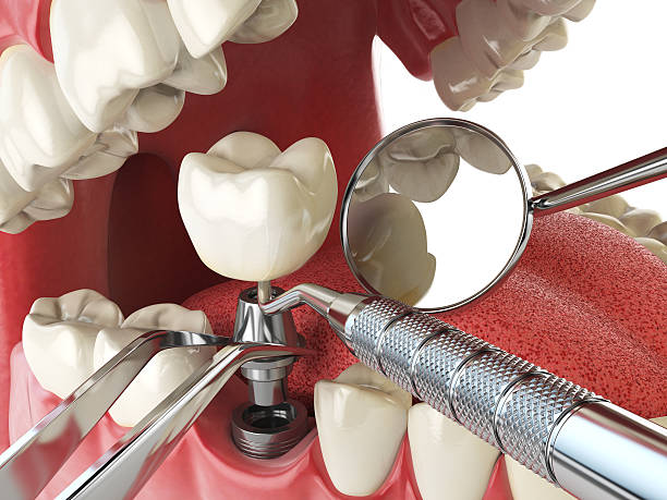 Best Emergency Dental Services for Seniors in Holyoke, CO